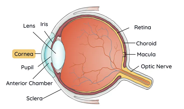 A comparison image of a clear vision and a vision blurred by cataracts.