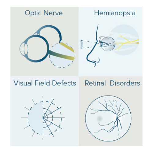 Optic Nerve Conditions